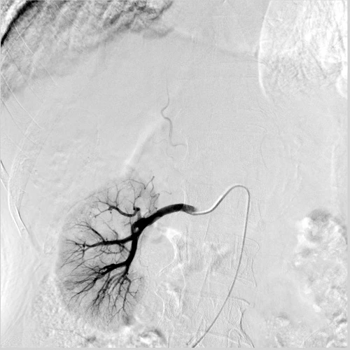 angiography machine